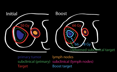 Schematic of an adaptive lung radiation therapy trial. Left side is the initial plan. Right side is the adapted plan, with the original target receiving 66 Gy and the residual gross disease receiving up to 78 Gy.