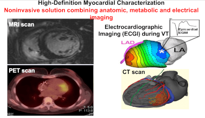 MRI, PET, CT, and ECGI of the heart.